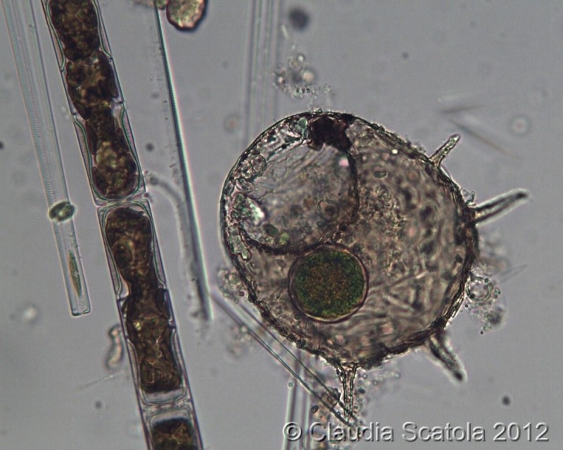 Ancora Centropyxis aculeata